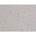 Phospho-BCL-2 (Ser70) Antibody in Immunohistochemistry (Paraffin) (IHC (P))