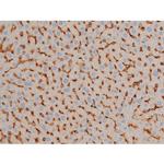 Phospho-BCL-2 (Ser70) Antibody in Immunohistochemistry (Paraffin) (IHC (P))