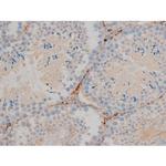 Phospho-BCL-2 (Ser70) Antibody in Immunohistochemistry (Paraffin) (IHC (P))