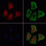 Phospho-FGFR1 (Tyr154) Antibody in Immunocytochemistry (ICC/IF)