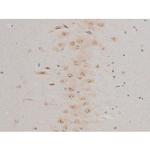 Phospho-GFAP (Ser38) Antibody in Immunohistochemistry (Paraffin) (IHC (P))