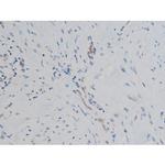 Phospho-GATA1 (Ser142) Antibody in Immunohistochemistry (Paraffin) (IHC (P))