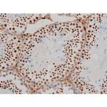 Phospho-GATA1 (Ser142) Antibody in Immunohistochemistry (Paraffin) (IHC (P))