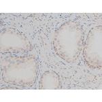 Phospho-GATA1 (Ser142) Antibody in Immunohistochemistry (Paraffin) (IHC (P))