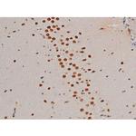 Phospho-GATA1 (Ser142) Antibody in Immunohistochemistry (Paraffin) (IHC (P))