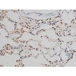 Phospho-GATA1 (Ser142) Antibody in Immunohistochemistry (Paraffin) (IHC (P))