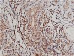 Phospho-VEGF Receptor 1 (Tyr1213) Antibody in Immunohistochemistry (Paraffin) (IHC (P))