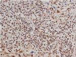 Phospho-VEGF Receptor 1 (Tyr1213) Antibody in Immunohistochemistry (Paraffin) (IHC (P))