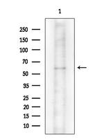 Phospho-PKR (Thr446) Antibody in Western Blot (WB)