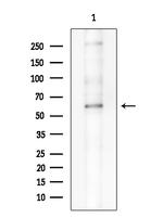 Phospho-PKR (Thr446) Antibody in Western Blot (WB)