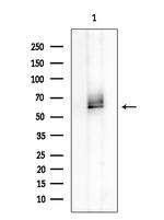 Phospho-PKR (Thr446) Antibody in Western Blot (WB)