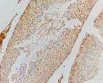 Phospho-PKR (Thr446) Antibody in Immunohistochemistry (Paraffin) (IHC (P))