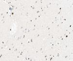 Phospho-NFkB p105 (Ser893) Antibody in Immunohistochemistry (Paraffin) (IHC (P))