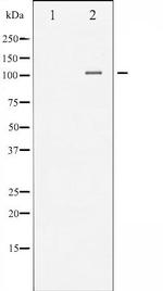 Phospho-NFkB p105 (Ser893) Antibody in Western Blot (WB)