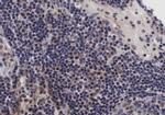 Phospho-NFkB p105/p50 (Ser907) Antibody in Immunohistochemistry (Paraffin) (IHC (P))