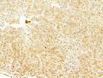 Phospho-SREBP1 (Ser439) Antibody in Immunohistochemistry (Paraffin) (IHC (P))