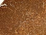 Phospho-SREBP1 (Ser439) Antibody in Immunohistochemistry (Paraffin) (IHC (P))