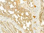 Phospho-SREBP1 (Ser439) Antibody in Immunohistochemistry (Paraffin) (IHC (P))