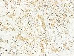 Phospho-SREBP1 (Ser439) Antibody in Immunohistochemistry (Paraffin) (IHC (P))