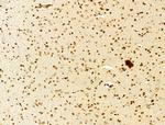 Phospho-SREBP1 (Ser439) Antibody in Immunohistochemistry (Paraffin) (IHC (P))