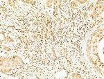 Phospho-SREBP1 (Ser439) Antibody in Immunohistochemistry (Paraffin) (IHC (P))