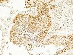 Phospho-SREBP1 (Ser439) Antibody in Immunohistochemistry (Paraffin) (IHC (P))