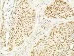 Phospho-SREBP1 (Ser439) Antibody in Immunohistochemistry (Paraffin) (IHC (P))