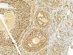 Phospho-SREBP1 (Ser439) Antibody in Immunohistochemistry (Paraffin) (IHC (P))