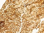 Phospho-SREBP1 (Ser439) Antibody in Immunohistochemistry (Paraffin) (IHC (P))