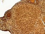 Phospho-SREBP1 (Ser439) Antibody in Immunohistochemistry (Paraffin) (IHC (P))