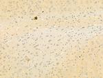 Phospho-SMAD2/SMAD3 (Thr8) Antibody in Immunohistochemistry (Paraffin) (IHC (P))