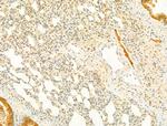 Phospho-SMAD2/SMAD3 (Thr8) Antibody in Immunohistochemistry (Paraffin) (IHC (P))