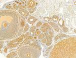 Phospho-SMAD2/SMAD3 (Thr8) Antibody in Immunohistochemistry (Paraffin) (IHC (P))