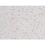 Phospho-PKC theta (Ser676) Antibody in Immunohistochemistry (Paraffin) (IHC (P))