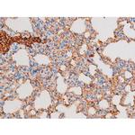 Phospho-PKC theta (Ser676) Antibody in Immunohistochemistry (Paraffin) (IHC (P))