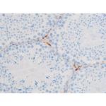 Phospho-PKC theta (Ser676) Antibody in Immunohistochemistry (Paraffin) (IHC (P))