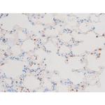 Phospho-PKC theta (Ser676) Antibody in Immunohistochemistry (Paraffin) (IHC (P))