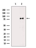 Phospho-HSL (Ser855, Ser554) Antibody in Western Blot (WB)