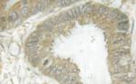 Phospho-HSL (Ser855, Ser554) Antibody in Immunohistochemistry (Paraffin) (IHC (P))