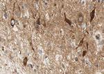 Phospho-HSL (Ser552) Antibody in Immunohistochemistry (Paraffin) (IHC (P))