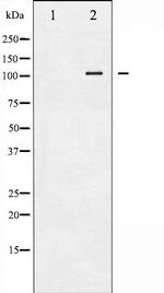 Phospho-HSL (Ser552) Antibody in Western Blot (WB)