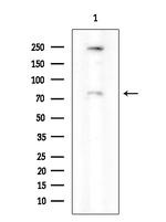 Phospho-PKC delta (Ser645) Antibody in Western Blot (WB)