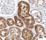 Phospho-4EBP1 (Thr45) Antibody in Immunohistochemistry (Paraffin) (IHC (P))