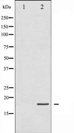 Phospho-4EBP1 (Thr45) Antibody in Western Blot (WB)