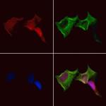 TWIST2 Antibody in Immunocytochemistry (ICC/IF)