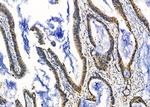 TWIST2 Antibody in Immunohistochemistry (Paraffin) (IHC (P))