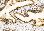 TWIST2 Antibody in Immunohistochemistry (Paraffin) (IHC (P))