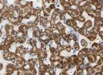 PIK3CA Antibody in Immunohistochemistry (Paraffin) (IHC (P))