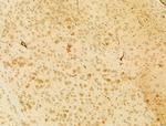 PIK3CA Antibody in Immunohistochemistry (Paraffin) (IHC (P))