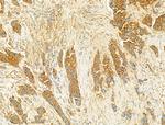 PIK3CA Antibody in Immunohistochemistry (Paraffin) (IHC (P))